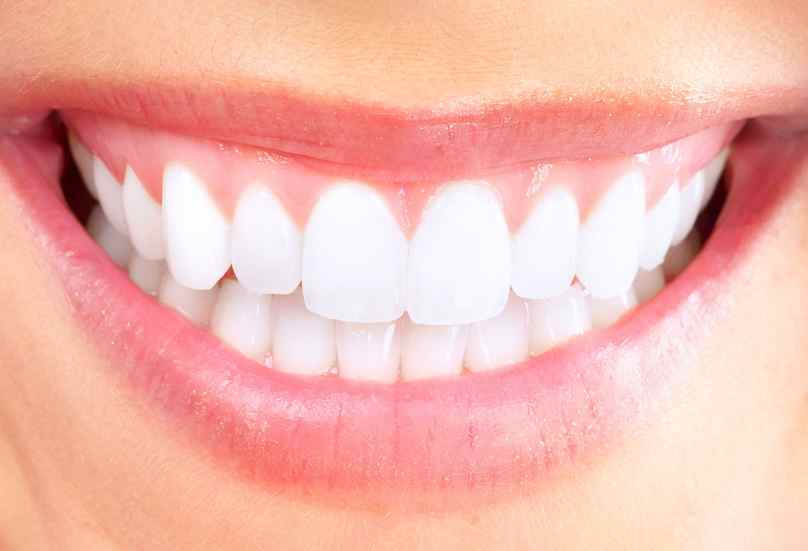 blanchir ses dents